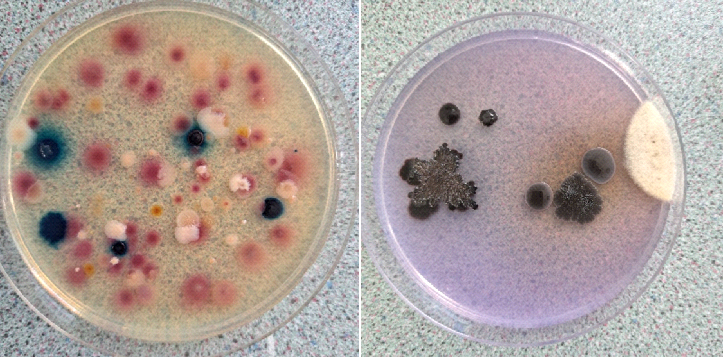 Fekális indikátor baktériumok kimutatása Duna vizéből (a) Chromocoult táptalajon. A kék telepek Escherichia coli, a rózsaszínű telepek egyéb koliform baktériumok. (b) Szita E-67 táptalajon fekális eredetű Enterococcus baktériumok figyelhetőek meg – fekete telepek